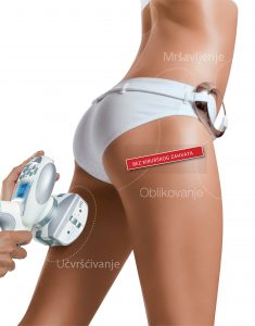 LPG Endermologie tretmani